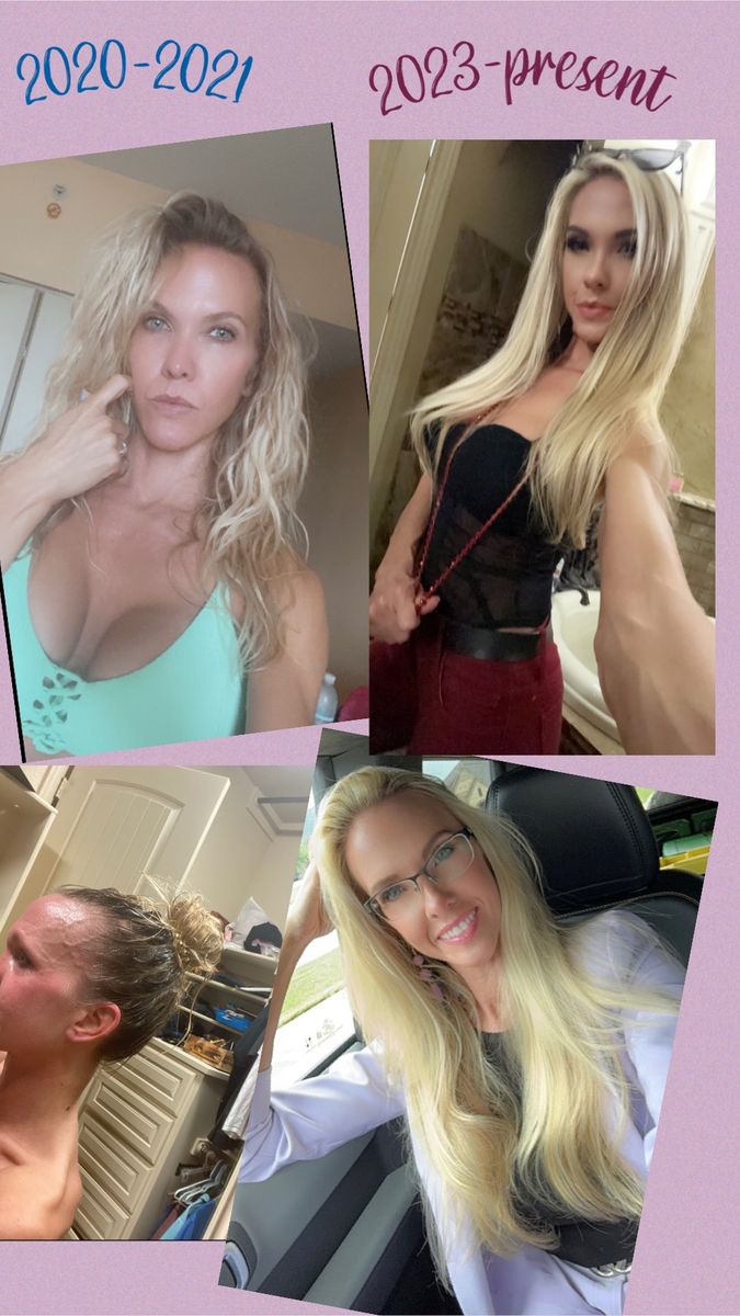 Before and after of Melissa showing new hair growth